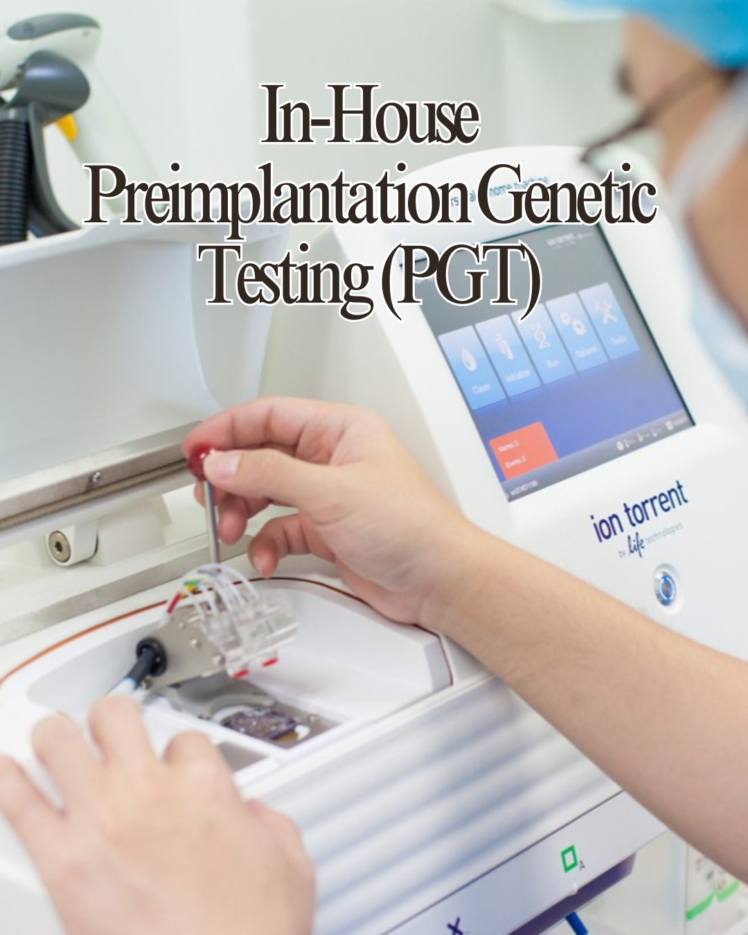 In-House Preimplantation Genetic Testing (PGT)