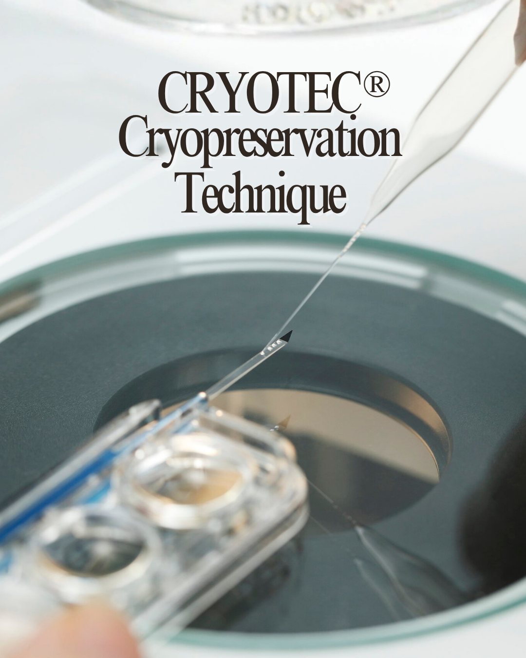 CRYOTEC® Method