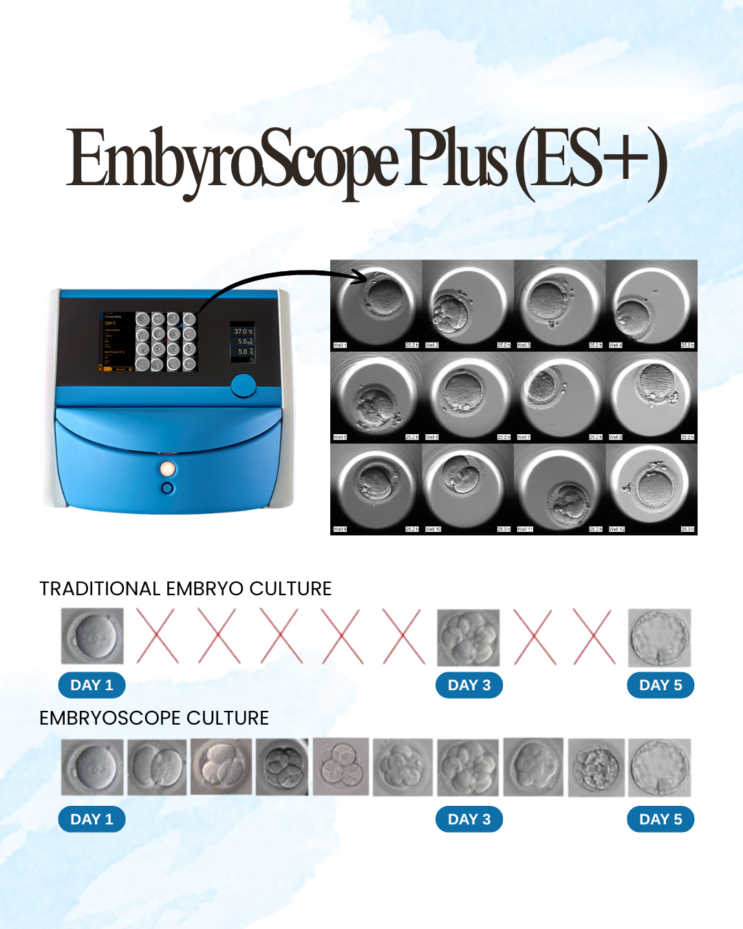 EMBRYOSCOPE+ Time-Lapse Incubator