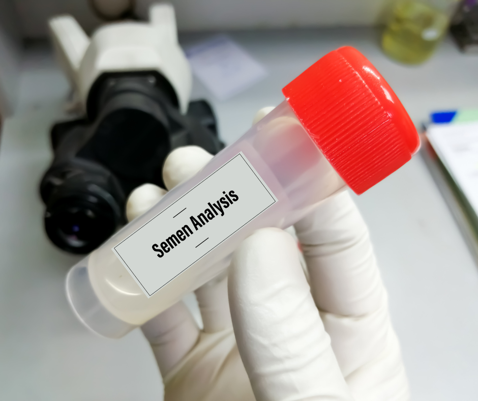 Man vs. Machine: Why AI Semen Analysis is Outperforming Manual Testing
